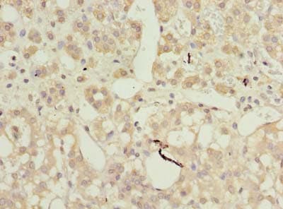 AP4B1 Antibody