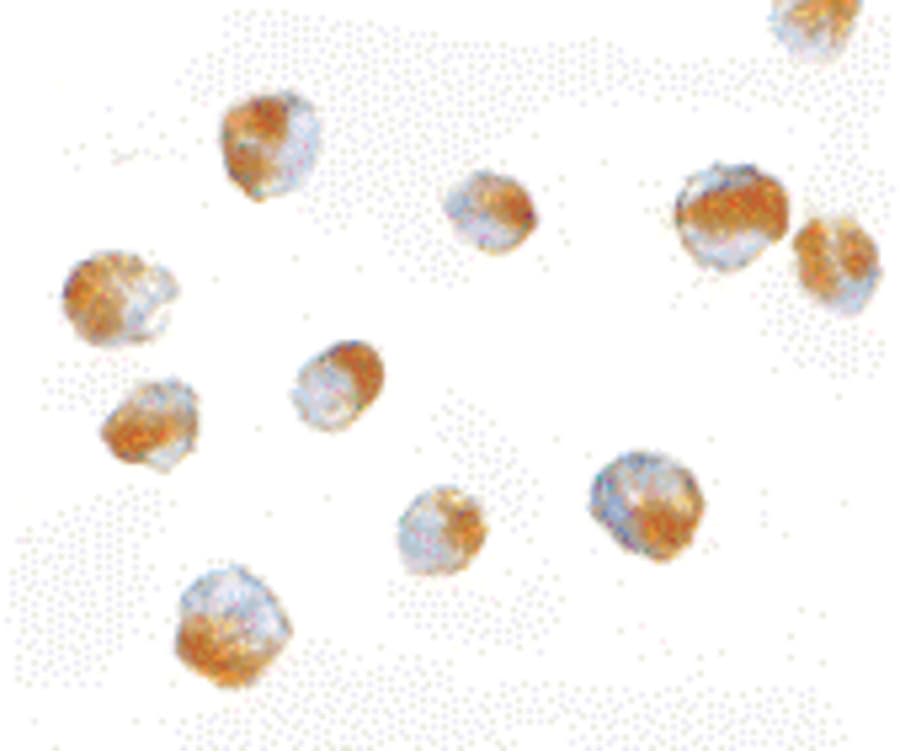 IHC-plus™ Polyclonal Rabbit anti-Human BUB3 Antibody (IHC, IF, WB)