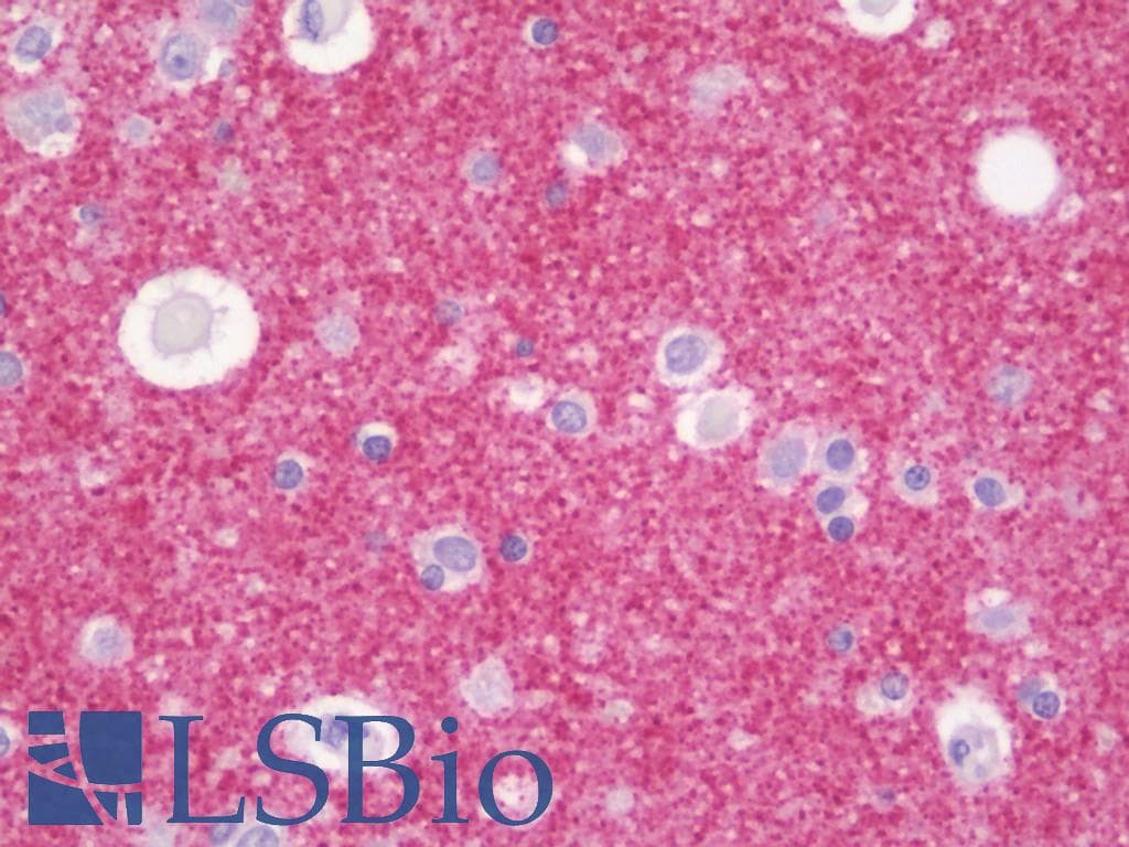 PathPlus™ SYP / Synaptophysin Antibody (clone 1C9)