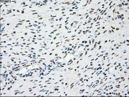 PLK1 / PLK-1 Antibody (clone OTI6C6)
