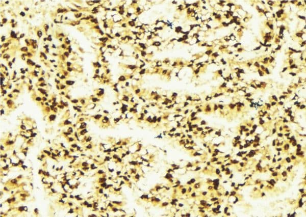 MALT1 Antibody