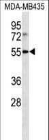 Polyclonal Rabbit anti-Human ILT3 / LILRB4 Antibody (aa44-73, WB)