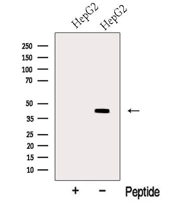 Polyclonal Rabbit anti-Human MTCH1 Antibody (WB)