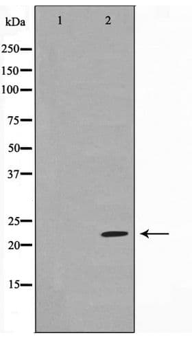 GBTS1 / DIRAS1 Antibody