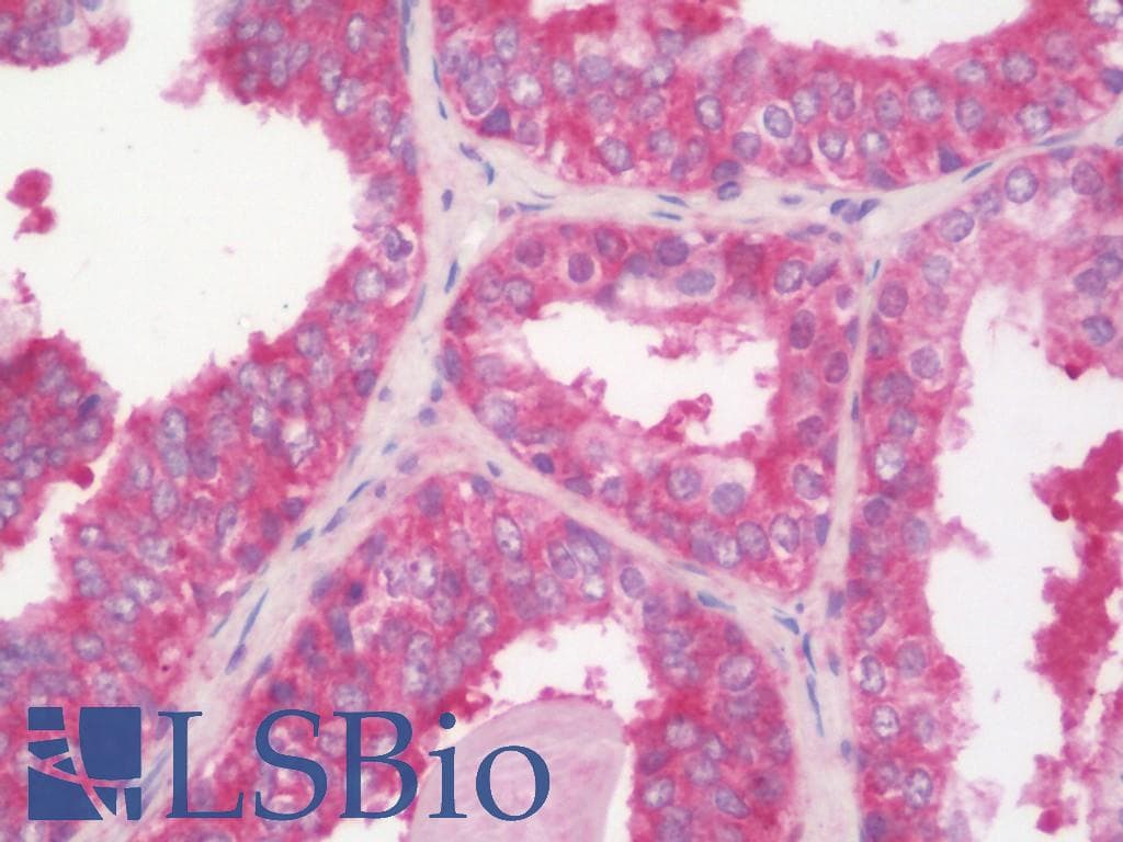 IHC-plus™ Polyclonal Rabbit anti-Human SLC16A13 Antibody (aa398-426, IHC, WB)
