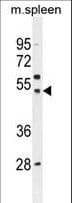 IHC-plus™ Polyclonal Rabbit anti-Human SLC16A13 Antibody (aa398-426, IHC, WB)