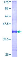 Human HLA-DOB Protein (Recombinant GST, N-terminus)