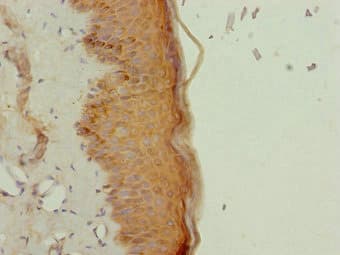 NR2E1 / TLX Antibody