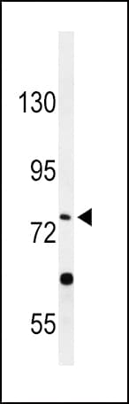 Polyclonal Rabbit anti-Human PLA2G6 / IPLA2 Antibody (aa551-580, IHC, IF, WB)