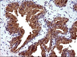 Monoclonal Mouse anti-Human PLA2G16 / HRASLS3 Antibody (clone OTI1A5, IHC, IF, WB)