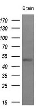 LAG3 Antibody (aa66-332, clone OTI5C3)
