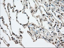 ACAT2 Antibody (clone OTI5F7)