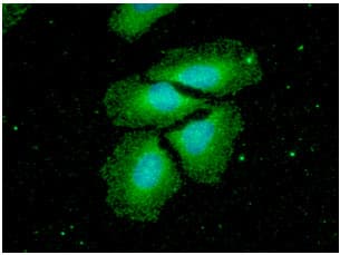 NME2 Antibody (clone AT2E3)