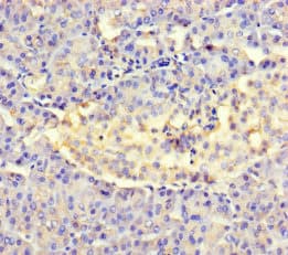 Polyclonal Rabbit anti-Human AMTN Antibody