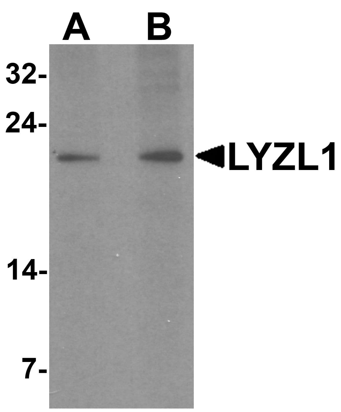 IHC-plus™ LYZL1 Antibody