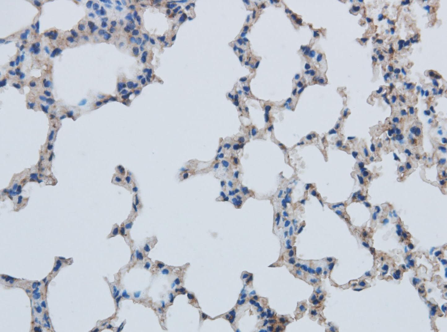 MMP1 Antibody