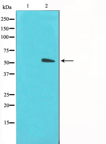 SLC2A3 / GLUT3 Antibody