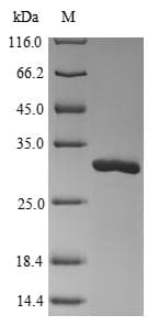 La Crosse Virus SARS-CoV Nucleoprotein (Recombinant 10His, N-terminus)