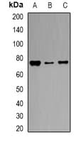 TF / Transferrin Antibody