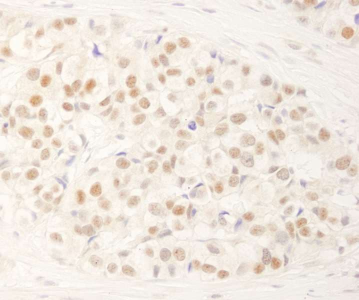 NRBF2 Antibody (aa125-175)