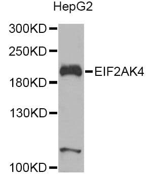 Polyclonal Rabbit anti-Human GCN2 Antibody (IHC, IF, WB)