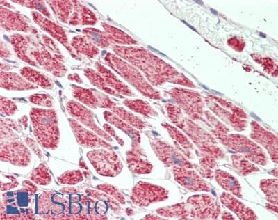 IHC-plus™ HADHA Antibody