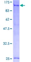 Human TFIP11 Protein (Recombinant GST)