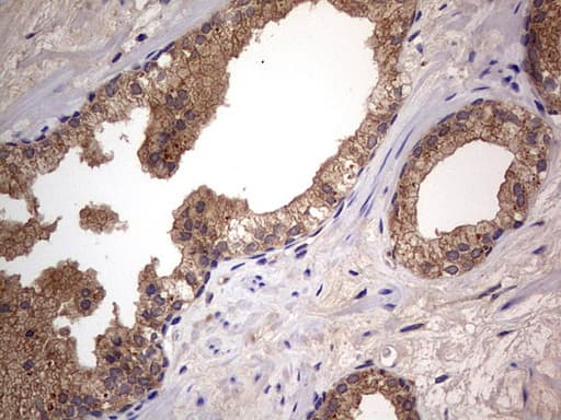 Monoclonal Mouse anti-Human ARAF / ARAF1 / A-RAF Antibody (clone OTI2G9, aa145-365, IHC, WB)