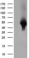 Monoclonal Mouse anti-Human HP / Haptoglobin Antibody (clone OTI4H5, IF, WB)