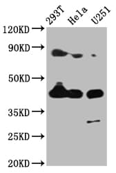 IHC-plus™ MSTN / GDF8 / Myostatin Antibody (aa 267-375)