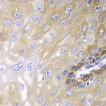Polyclonal Rabbit anti-Human ARRB1 / Beta Arrestin 1 Antibody (IHC, IF, WB)