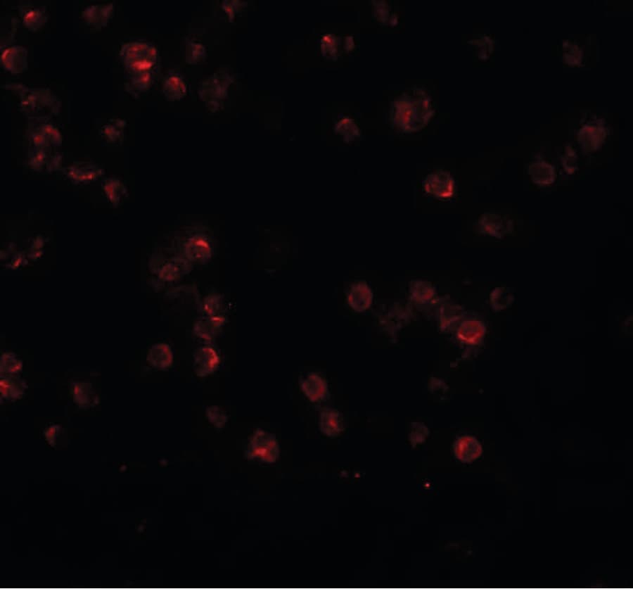 IHC-plus™ Polyclonal Rabbit anti-Human ANAPC13 Antibody (IHC, IF, WB)