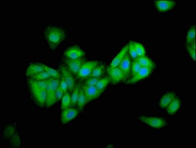 Polyclonal Rabbit anti-Human PNPLA5 Antibody (IHC, IF, WB)
