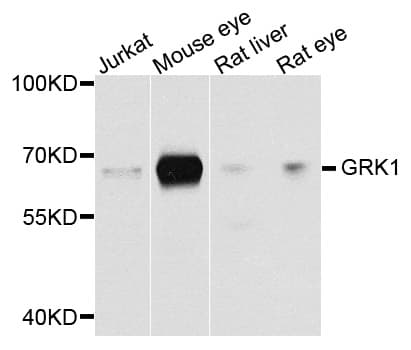 Polyclonal Rabbit anti-Human Rhodopsin Kinase / GRK1 Antibody (IHC, WB)