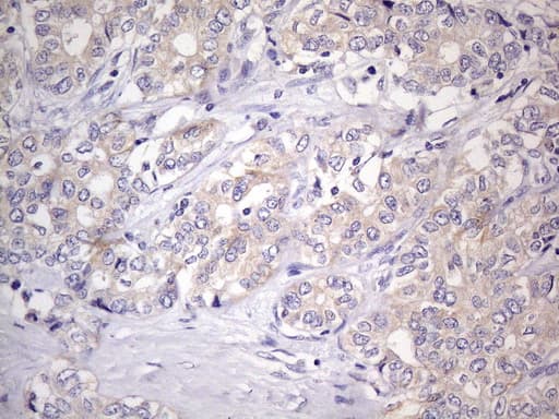 Monoclonal Mouse anti-Human GEMIN8 Antibody (clone UMAB185, IHC, WB)