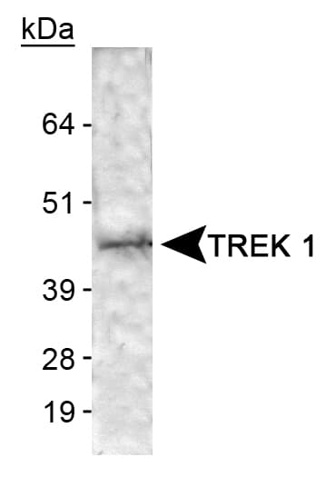 KCNK2 / TREK-1 Antibody (aa1-100)