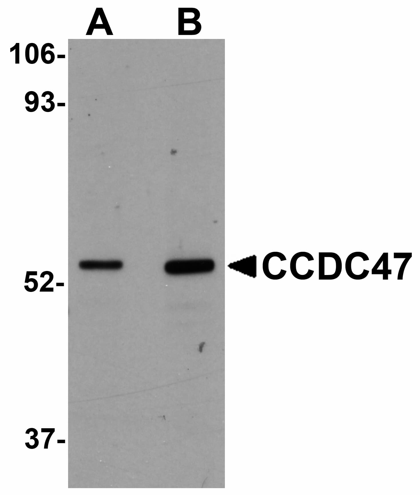IHC-plus™ CCDC47 Antibody
