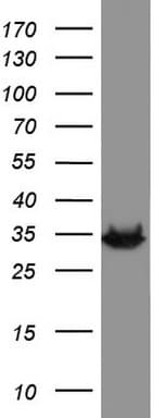 Monoclonal Mouse anti-Human HADH Antibody (clone UMAB151, aa57-314, IHC, WB)