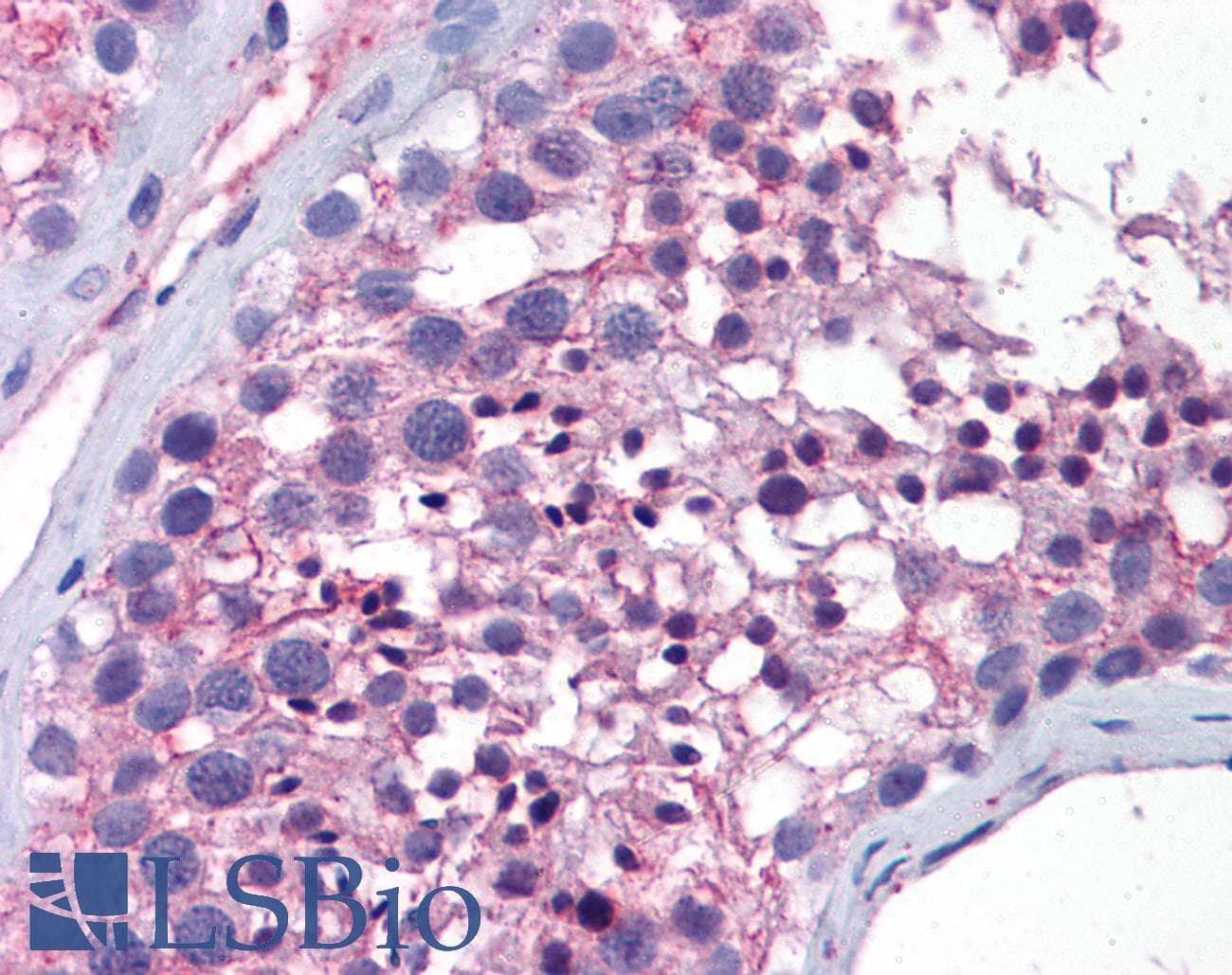 Polyclonal Rabbit anti-Mouse WNT10A Antibody (aa101-150, IHC, WB)