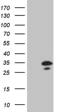 CLTA / LCA Antibody (clone OTI2C2)