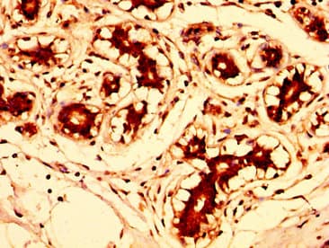 Polyclonal Rabbit anti-Human FUT8 Antibody (IHC, WB)