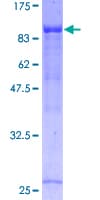 Human NOL4 Protein (Recombinant GST)