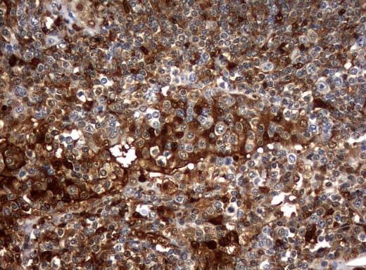Monoclonal Mouse anti-Human TP / Thymidine Phosphorylase Antibody (clone UMAB90, aa311-482, IHC, WB)