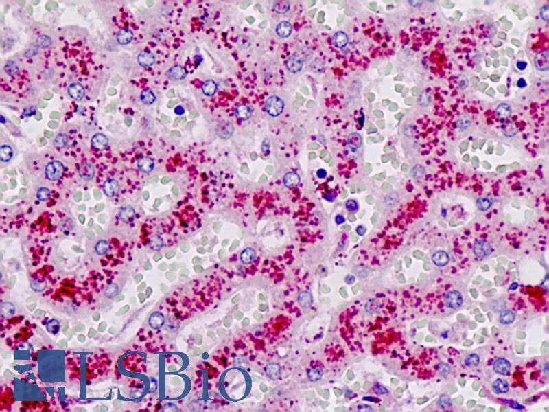 IHC-plus™ CTSD / Cathepsin D Antibody