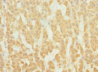 RAB23 Antibody