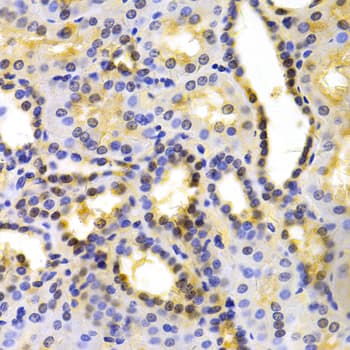 KIF2C / MCAK Antibody