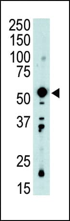 PDK2 Antibody (aa378-407)