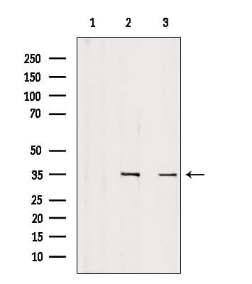 SULT1C2 / Sulfotransferase 1C2 Antibody