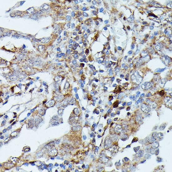 MAP3K3 / MEKK3 Antibody