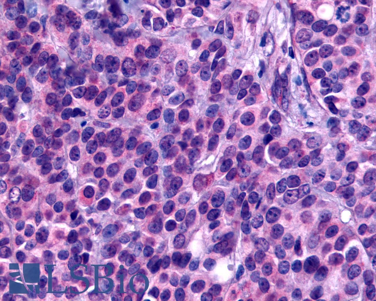 PathPlus™ GPCR6 / GPR101 Antibody (Cytoplasmic Domain)